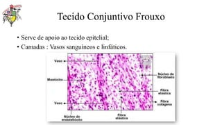 Tecido Conjuntivo Frouxo
• Serve de apoio ao tecido epitelial;
• Camadas : Vasos sanguíneos e linfáticos.
 