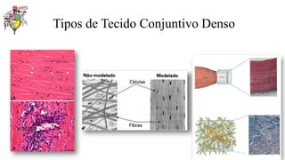 Tipos de Tecido Conjuntivo Denso
 