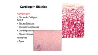 Cartilagem Elástica
Composição:
• Fibras de Colágeno
tipo II
• Fibras Elásticas
• Glicosaminoglicanas
• Groteoglicanas
• Glicoproteínas
•adesivas
• Água
 