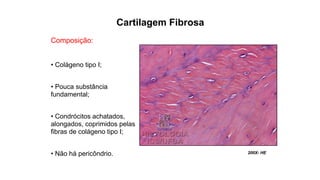 200X- HE
Composição:
• Colágeno tipo I;
• Pouca substância
fundamental;
• Condrócitos achatados,
alongados, coprimidos pelas
fibras de colágeno tipo I;
• Não há pericôndrio.
Cartilagem Fibrosa
 