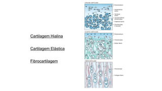 Cartilagem Hialina
Cartilagem Elástica
Fibrocartilagem
 
