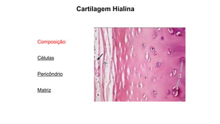 Cartilagem Hialina
Composição:
Células
Pericôndrio
Matriz
 