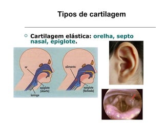 Tipos de cartilagem

   Cartilagem elástica: orelha, septo
    nasal, epiglote.
 
