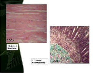 T.C.Denso
Modelado
T.C.Denso
Não Modelado
 