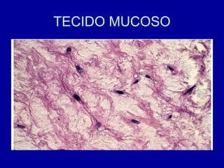 Tecido conjuntivo parte 1 | PPT