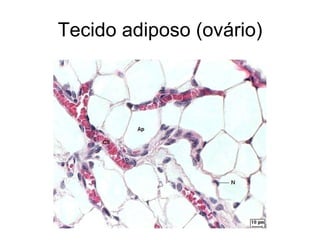 Tecido adiposo (ovário) 