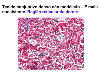 Tecido conjuntivo denso não modelado – É mais consistente.  Região reticular da derme 