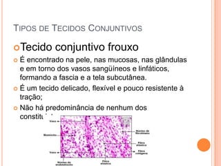 TIPOS DE TECIDOS CONJUNTIVOS

Tecido conjuntivo frouxo
 É encontrado na pele, nas mucosas, nas glândulas
  e em torno dos vasos sangüíneos e linfáticos,
  formando a fascia e a tela subcutânea.
 É um tecido delicado, flexível e pouco resistente à
  tração;
 Não há predominância de nenhum dos
  constituintes;
 
