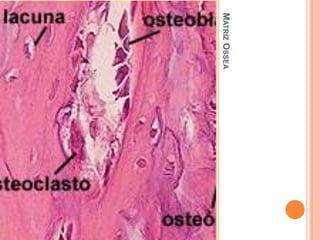 MATRIZ OSSEA
 