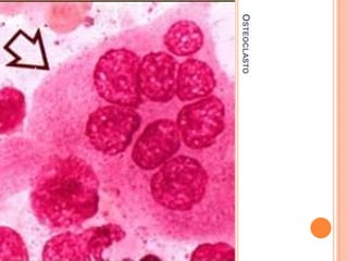 OSTEOCLASTO
 