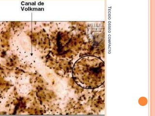 TECIDO ÓSSEO COMPACTO
 