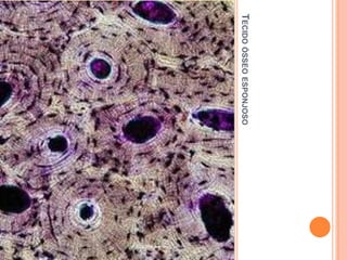 TECIDO ÓSSEO ESPONJOSO
 