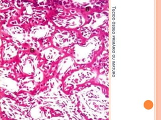 TECIDO ÓSSEO PRIMÁRIO OU IMATURO
 