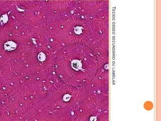 TECIDO ÓSSEO SECUNDÁRIO OU LAMELAR
 