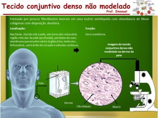 Tecido conjuntivo denso não modelado
                             Prof. Emanuel
 