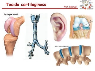 Tecido cartilaginoso   Prof. Emanuel
 