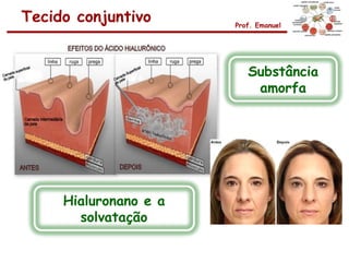 Tecido conjuntivo      Prof. Emanuel




                          Substância
                           amorfa




     Hialuronano e a
       solvatação
 