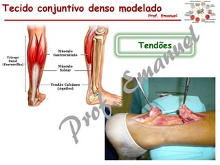 Tecido conjuntivo denso modelado
Prof. Emanuel
Tendões
 