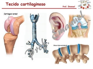 Tecido cartilaginoso Prof. Emanuel
 