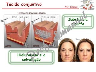 Tecido conjuntivo Prof. Emanuel
Substância
amorfa
Hialuronano e a
solvatação
 