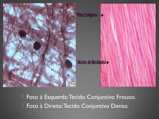  Foto à Esquerda:Tecido Conjuntivo Frouxo.
 Foto à Direita:Tecido Conjuntivo Denso.
 