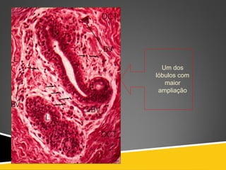 Um dos
lóbulos com
maior
ampliação
 