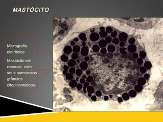 MASTÓCITO
Micrografia
eletrônica
Mastócito em
repouso, com
seus numerosos
grânulos
citoplasmáticos.
 