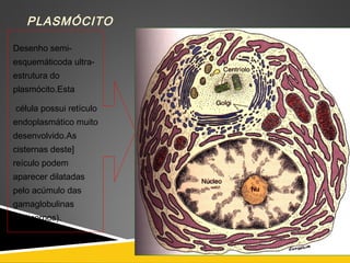 PLASMÓCITO
Desenho semi-
esquemáticoda ultra-
estrutura do
plasmócito.Esta
célula possui retículo
endoplasmático muito
desenvolvido.As
cisternas deste]
reículo podem
aparecer dilatadas
pelo acúmulo das
gamaglobulinas
(anticorpos).
 
