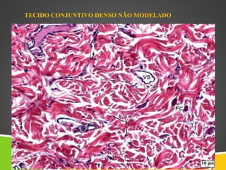 TECIDO CONJUNTIVO DENSO NÃO MODELADO
 