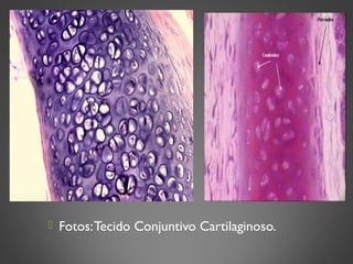  Fotos:Tecido Conjuntivo Cartilaginoso.
 