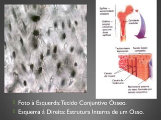  Foto à Esquerda:Tecido Conjuntivo Ósseo.
 Esquema à Direita: Estrutura Interna de um Osso.
 