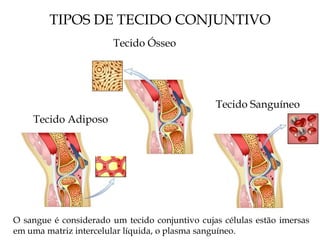 TIPOS DE TECIDO CONJUNTIVO
Tecido Ósseo
Tecido Adiposo
Tecido Sanguíneo
O sangue é considerado um tecido conjuntivo cujas células estão imersas
em uma matriz intercelular líquida, o plasma sanguíneo.
 
