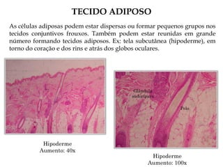 TECIDO ADIPOSO
As células adiposas podem estar dispersas ou formar pequenos grupos nos
tecidos conjuntivos frouxos. Também podem estar reunidas em grande
número formando tecidos adiposos. Ex: tela subcutânea (hipoderme), em
torno do coração e dos rins e atrás dos globos oculares.
Hipoderme
Aumento: 40x
Hipoderme
Aumento: 100x
Pelo
Glândula
sudorípara
 