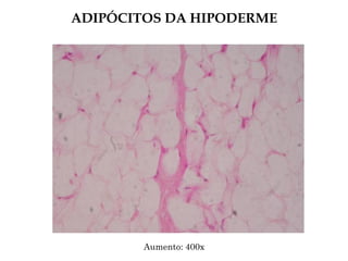 ADIPÓCITOS DA HIPODERME
Aumento: 400x
 