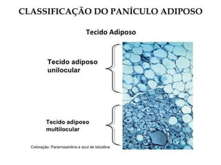 CLASSIFICAÇÃO DO PANÍCULO ADIPOSO
 