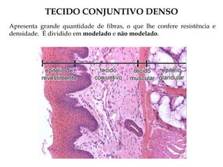 TECIDO CONJUNTIVO DENSO
Apresenta grande quantidade de fibras, o que lhe confere resistência e
densidade. É dividido em modelado e não modelado.
 