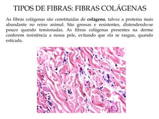 TIPOS DE FIBRAS: FIBRAS COLÁGENAS
As fibras colágenas são constituídas de colágeno, talvez a proteína mais
abundante no reino animal. São grossas e resistentes, distendendo-se
pouco quando tensionadas. As fibras colágenas presentes na derme
conferem resistência a nossa pele, evitando que ela se rasgue, quando
esticada.
 