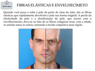 FIBRAS ELÁSTICAS E ENVELHECIMETO
Quando você puxa e solta à pele da parte de cima da mão, são as fibras
elásticas que rapidamente devolvem à pele sua forma original. A perda da
elasticidade da pele e a desidratação da pele, que ocorre com o
envelhecimento, deve-se ao fato de as fibras colágenas irem, com a idade,
se unindo umas às outras, tornando o tecido conjuntivo mais rígido .
 