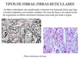 TIPOS DE FIBRAS: FIBRAS RETICULARES
As fibras reticulares são ramificadas e formam um trançado firme que liga
o tecido conjuntivo aos tecidos vizinhos. No caso do baço e de outros locais
do organismo as fibras reticulares formam uma rede por todo o órgão.
Fibras reticulares do baço
 