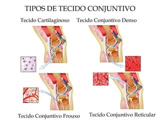 TIPOS DE TECIDO CONJUNTIVO
Tecido Conjuntivo Reticular
Tecido Conjuntivo Frouxo
Tecido Cartilaginoso Tecido Conjuntivo Denso
 