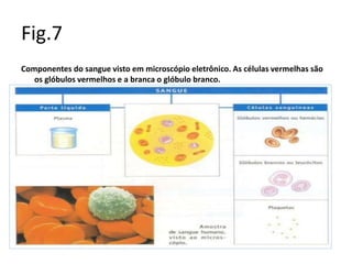 Fig.7
Componentes do sangue visto em microscópio eletrônico. As células vermelhas são
os glóbulos vermelhos e a branca o glóbulo branco.
 