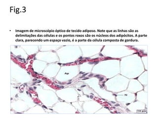 Fig.3
• Imagem de microscópio óptico de tecido adiposo. Note que as linhas são as
delimitações das células e os pontos roxos são os núcleos dos adipócitos. A parte
clara, parecendo um espaço vazio, é a parte da célula composta de gordura.
 