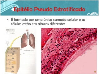 Epitélio Pseudo Estratificado É formado por uma única camada celular e as células estão em alturas diferentes 