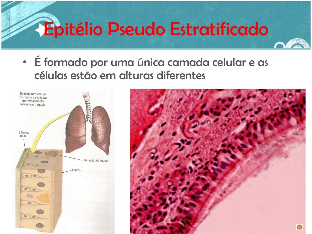 Com Relação Ao Tecido Epitelial Considere As Afirmativas Abaixo