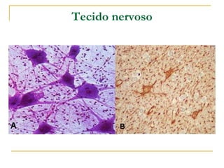 Tecido nervoso
 