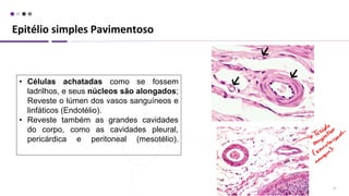 Epitélio simples Pavimentoso
14
• Células achatadas como se fossem
ladrilhos, e seus núcleos são alongados;
Reveste o lúmen dos vasos sanguíneos e
linfáticos (Endotélio).
• Reveste também as grandes cavidades
do corpo, como as cavidades pleural,
pericárdica e peritoneal (mesotélio).
 