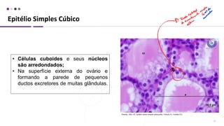 Epitélio Simples Cúbico
15
• Células cuboides e seus núcleos
são arredondados;
• Na superfície externa do ovário e
formando a parede de pequenos
ductos excretores de muitas glândulas.
 