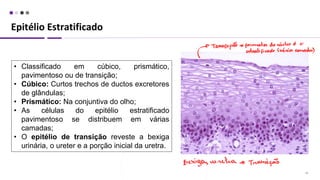 Epitélio Estratificado
18
• Classificado em cúbico, prismático,
pavimentoso ou de transição;
• Cúbico: Curtos trechos de ductos excretores
de glândulas;
• Prismático: Na conjuntiva do olho;
• As células do epitélio estratificado
pavimentoso se distribuem em várias
camadas;
• O epitélio de transição reveste a bexiga
urinária, o ureter e a porção inicial da uretra.
 