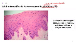 Epitélio Estratificado Pavimentoso não queratinizado
19
Cavidades úmidas (ex:
boca, esôfago, vagina),
sujeitas a atrito e a
forças mecânicas
 