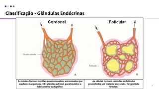 Classificação - Glândulas Endócrinas
31
As células formam cordões anastomosados, entremeados por
capilares sanguíneos. EX: glândula adrenal, paratireoide e o
lobo anterior da hipófise.
As células formam vesículas ou folículos
preenchidos por material secretado. Ex: glândula
tireoide.
 
